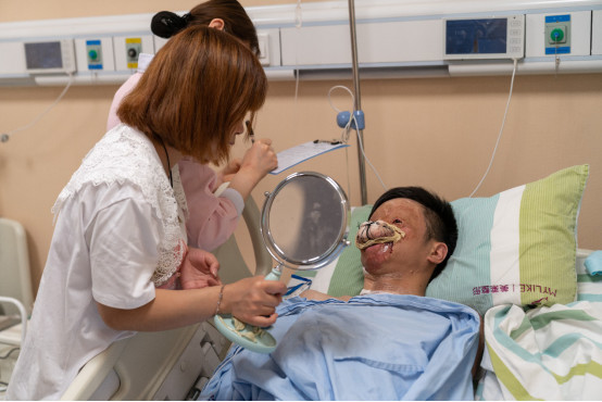 重度烧伤主播接受手术女友悉心照顾不离不弃