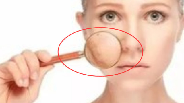 肝癌早期不痛不痒一旦鼻子和眼睛出现这症状是肝脏在向你求救