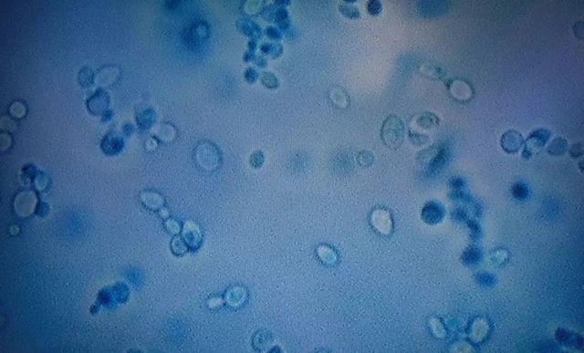 超级真菌肆虐全球!18名中国人感染,美国列为