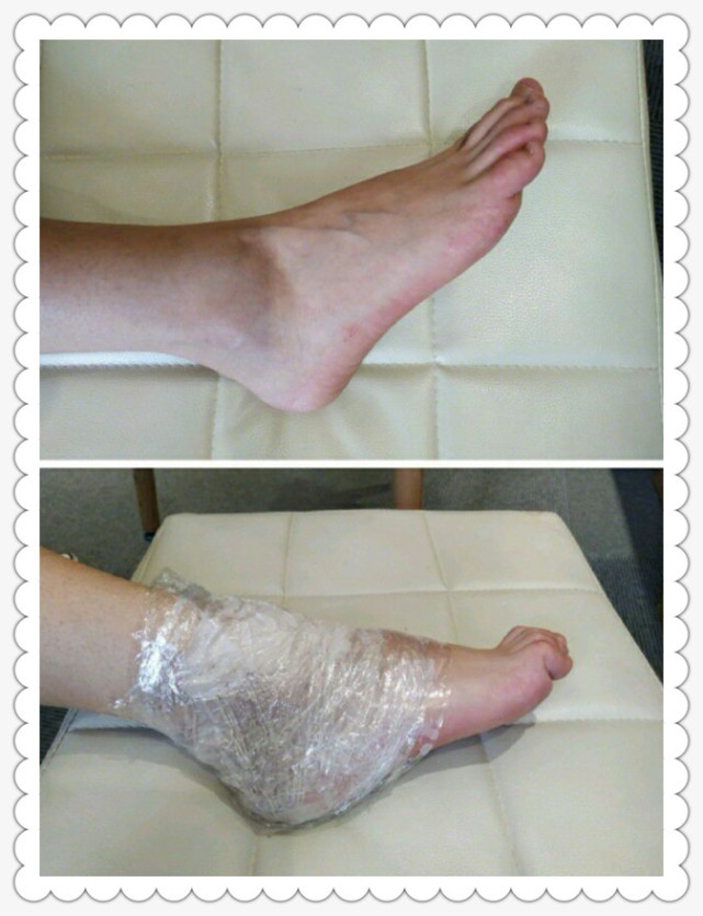 这两步除了美白脚踝之外像是膝盖和胳膊肘黑的地方也可以使用,材料都