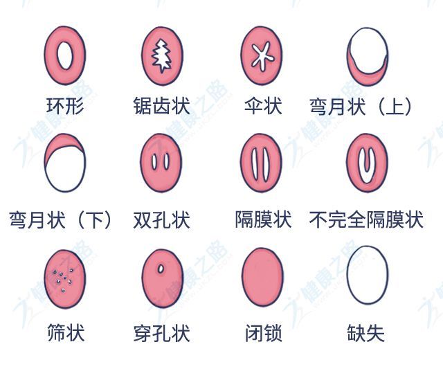 不过,约有2%的姑娘处女膜上的孔太小,以至于不能使用棉条.