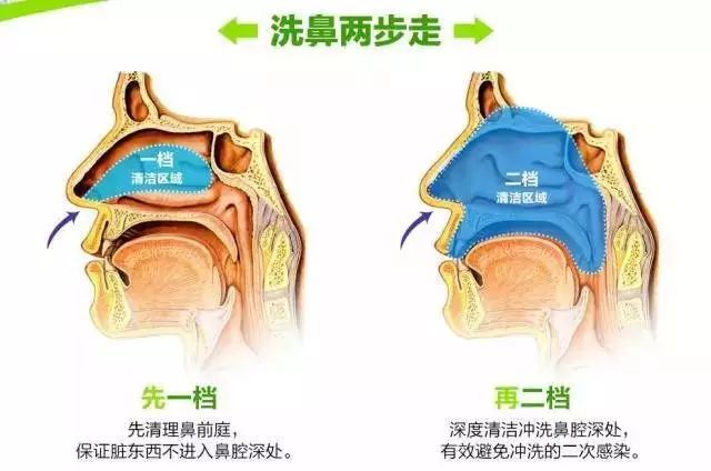 花开柳絮飞又过敏了吧鼻涕像流水喷嚏连打几十个甚至满身起疙瘩