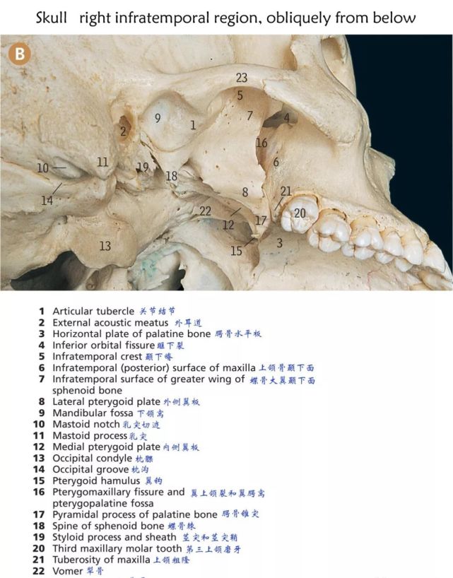 附著點:主要腦顱骨分別展示:額骨(frontal bone):篩骨:蝶骨:顳骨:枕骨