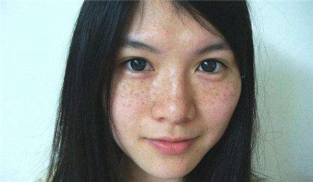 别让色斑毁了一张脸,学会三个淡斑小技巧,肌肤变得白皙又干净