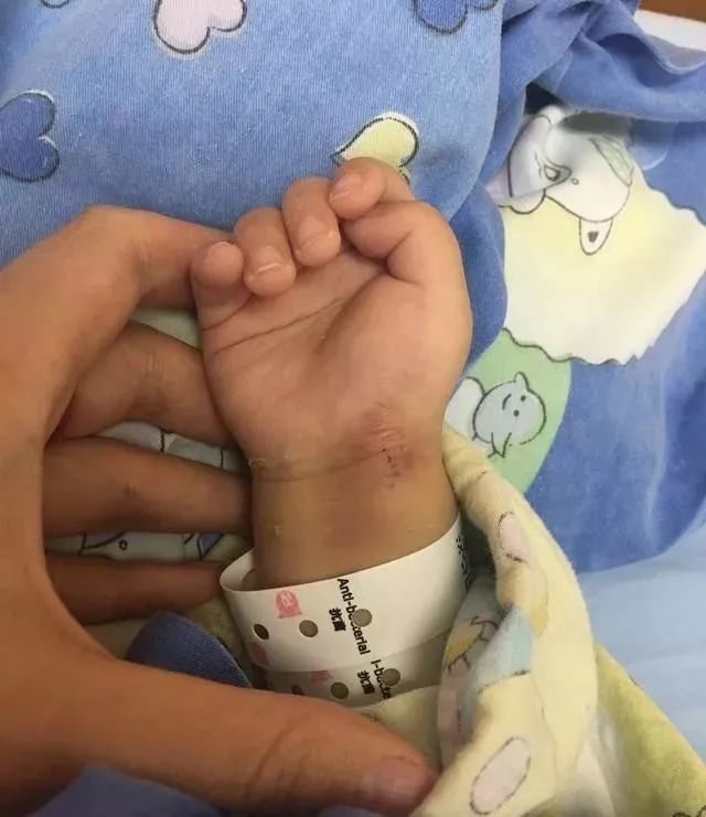 我家宝宝打了保胎针,生出来是这样的,不知道是哪里搞错了!