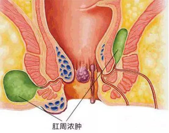 北京肛肠专科医院：聚焦专业与服务
