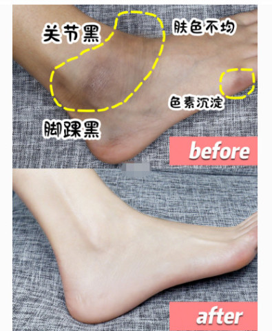 脚踝黑到泯灭众人 自制超强磨砂膏 教你美白独门秘籍