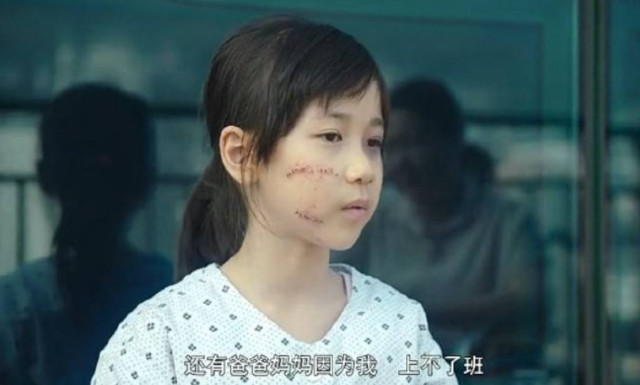 素媛原型娜英伤口照片图片大全素媛娜英真人照片2022已更新今日更新