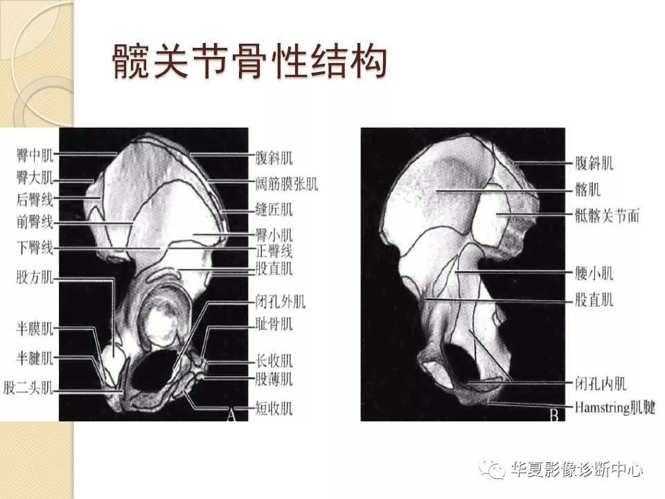 骨科精讀從髖關節的解剖到手術入路全過程你要的解答全在這