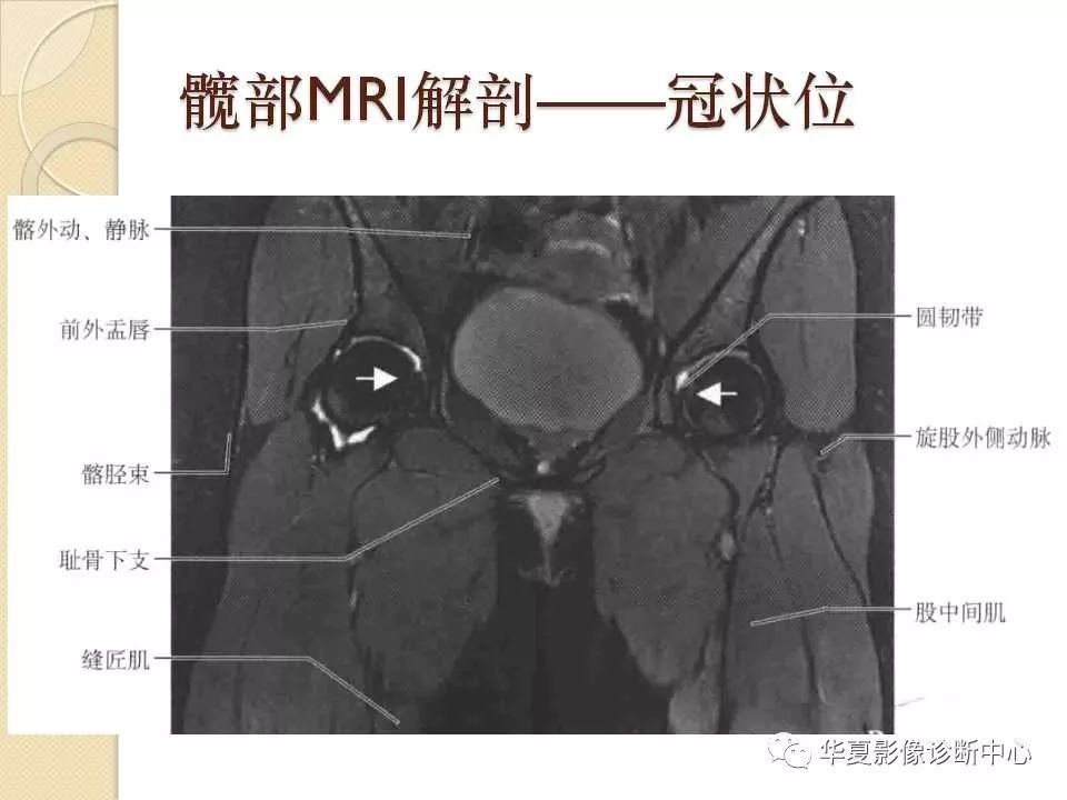 骨科精读从髋关节的解剖到手术入路全过程你要的解答全在这