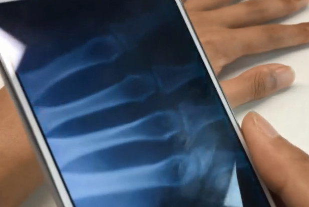 手机可以拍"x光"?看到成片后,大神求教程!