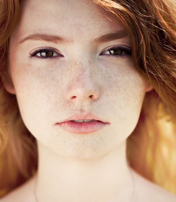 有些人认为脸上有雀斑无关紧要 认为雀斑是可爱的代表 那么雀斑是怎么形成的 腾讯网