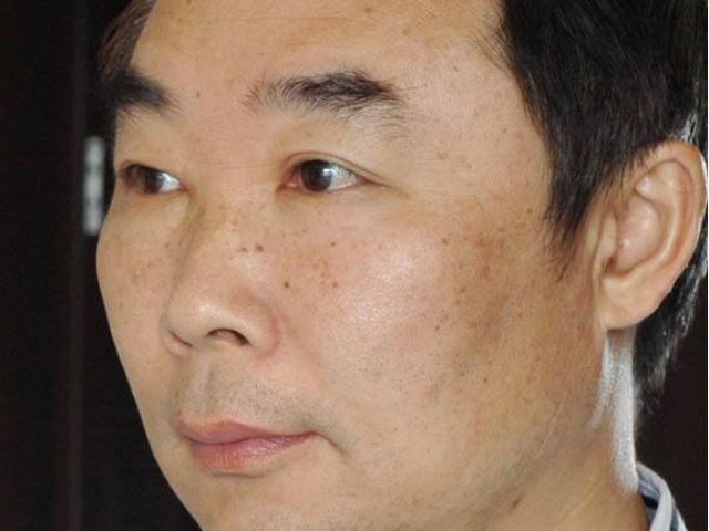 肾功能"糟糕"的男人,早起头上有"3迹象",别拖成尿毒症!