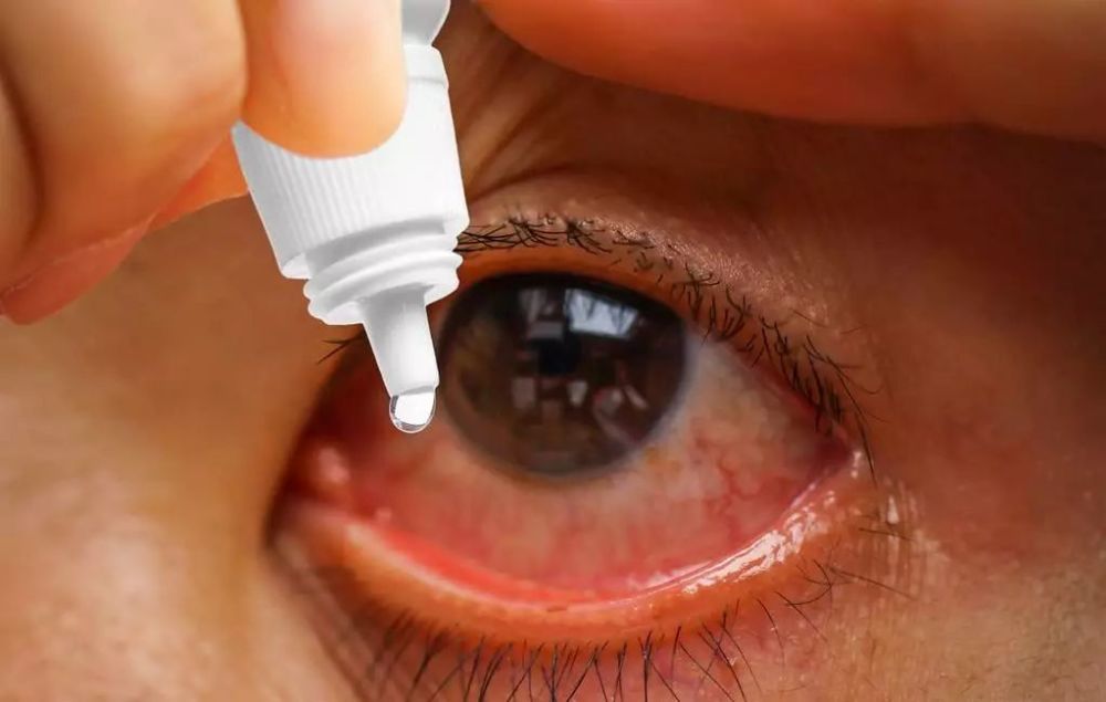 眼痒鼻痒打喷嚏 可能都是过敏 告诉医生可以省药钱