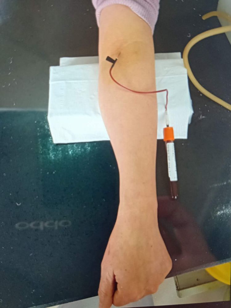 患者采血静脉看不见一招快速搞定