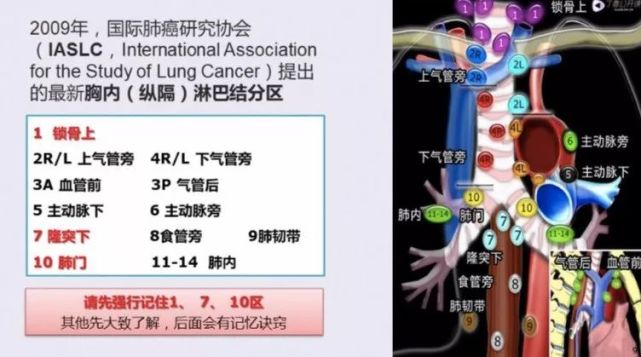 但結構複雜,應該如何快速分區記憶?