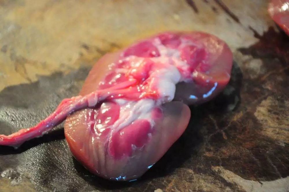 尿酸|36岁男子，尿酸高达850，突发肾衰竭入院，这2种东西害人不浅