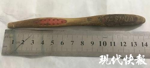 大妈吞下14厘米长牙刷没当回事淡定了9个月