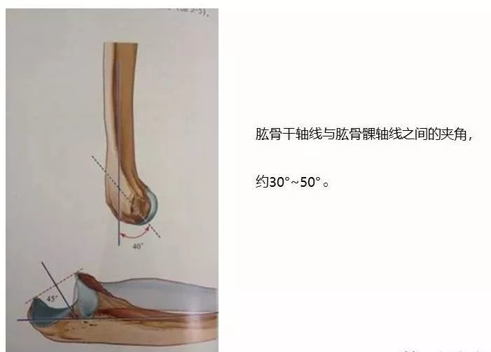 一文了解骨科常用的角度测量方法汇总