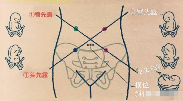 4个月胎心在哪个位置呢 一般听胎心在什么位置呢 看完颠覆认知 腾讯网