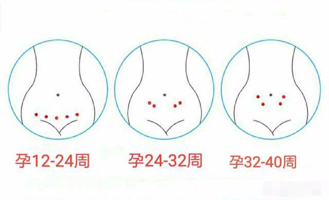 4个月胎心在哪个位置呢 一般听胎心在什么位置呢 看完颠覆认知 腾讯网