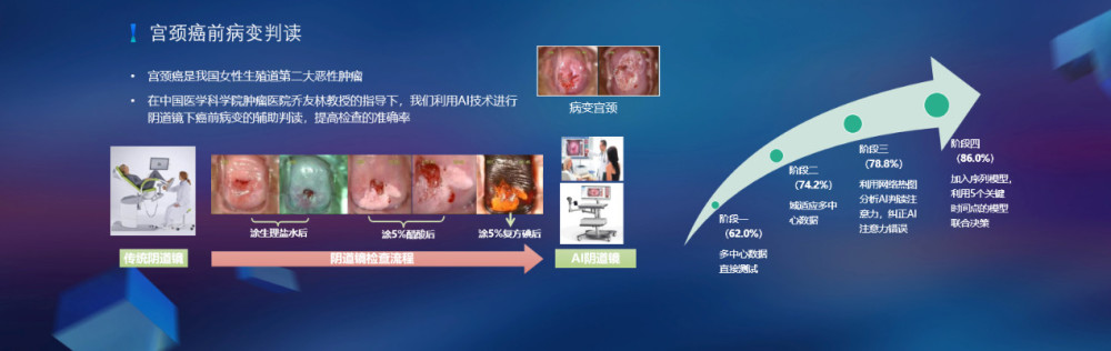 宮頸癌的篩查階段主要分為三步:hpv檢測或宮頸脫落細胞學初篩,初篩陽