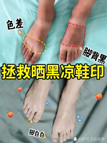 美白神操作 用到烂 的方法白到不怕晒 拯救夏季晒黑凉鞋印