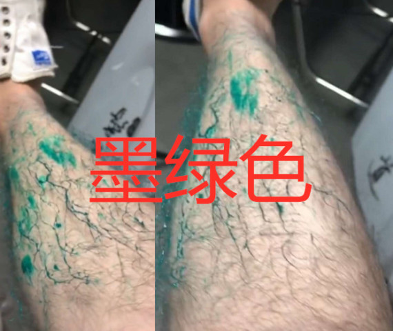 同样是染腿毛,忍了脏脏橘,忍了大红色,看到最后:臣妾做不到啊