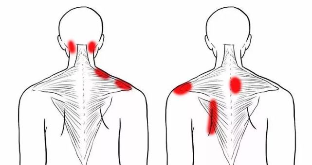 精准拉伸解剖图,告别肩颈腰背疼痛|肌肉|手臂