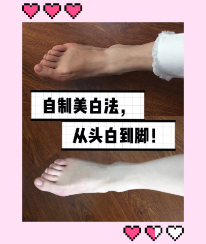 纯干货 脚部被 晒黑 后的修复方法 避免穿凉鞋太尬