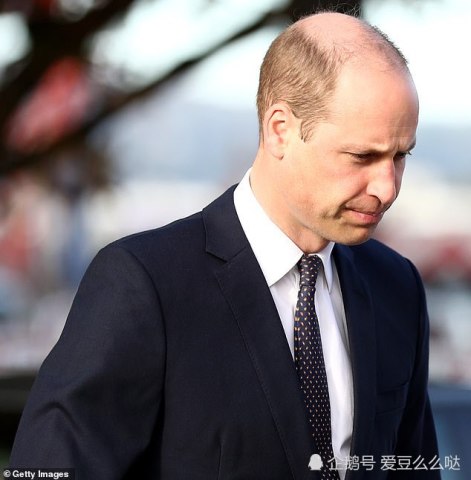 威廉王子又被调侃发际线,只怪基因太强大