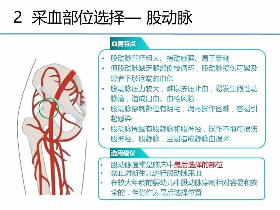 ppt动脉采血临床操作指南