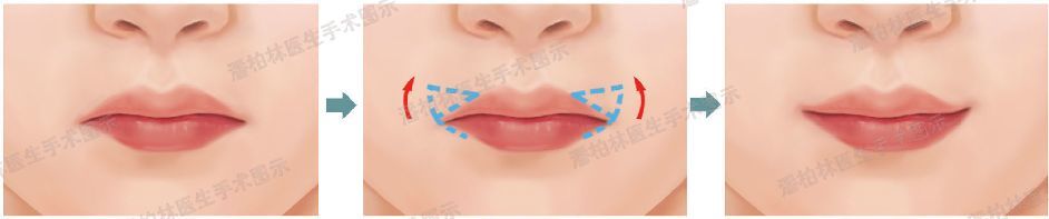 迪丽热巴猫眼妆被夸美炸天 但没有小猫嘴还是输了