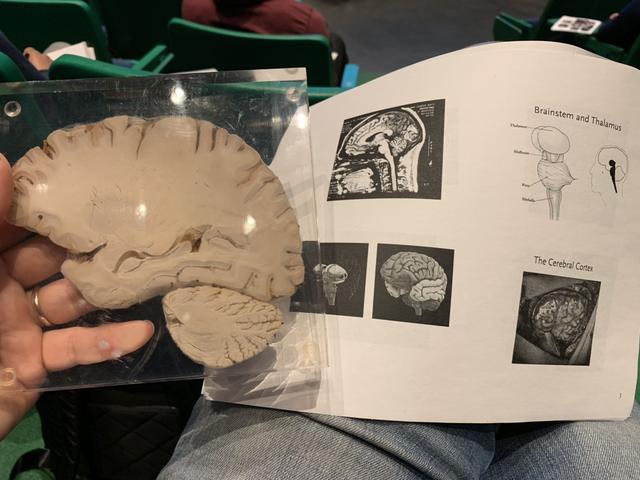 (脑科学课上,第一次手拿真实大脑切片)