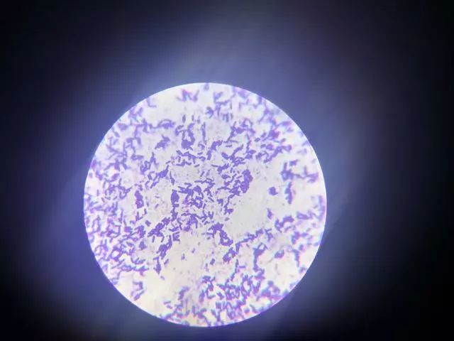 水产养殖户们建议收藏!