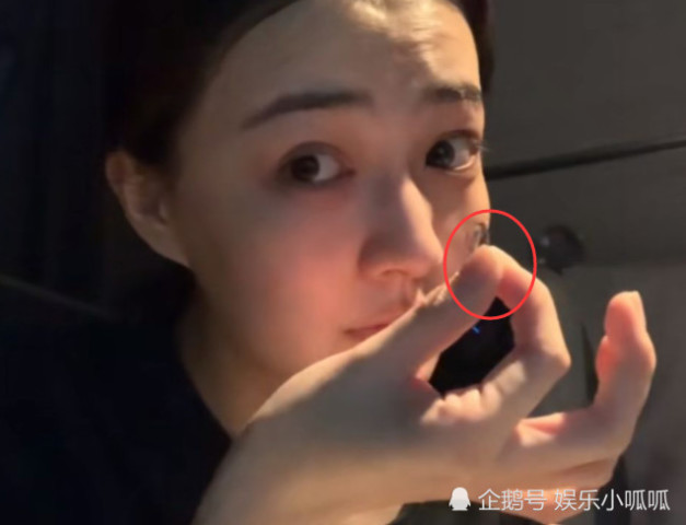 徐璐摘隐形眼镜,不用镊子眼一瞪取下,网友:这眼