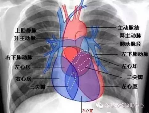 胸部血管 縱隔分區胸部ct影像示意圖心室層面左右房室層面左心房層面