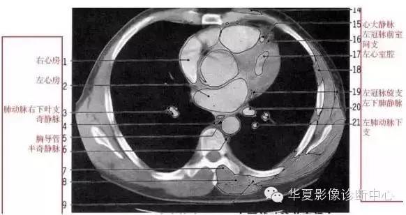 影像解剖▕胸部