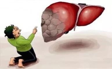 乙型病毒性肝炎|肝癌是怎么来的？如何预防？
