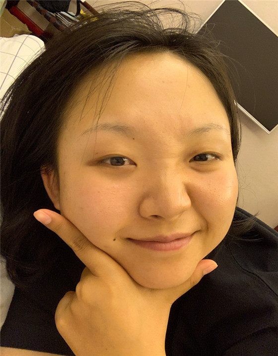 辣目洋子晒素颜照,毛孔明显眉毛淡到几乎"消失",打脸一众女星