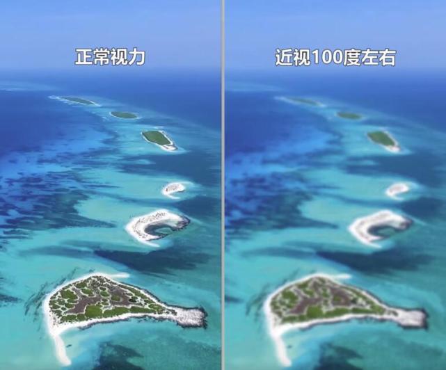 正常视力到近视1000度视野怎么变化看到最后瞎了嘛