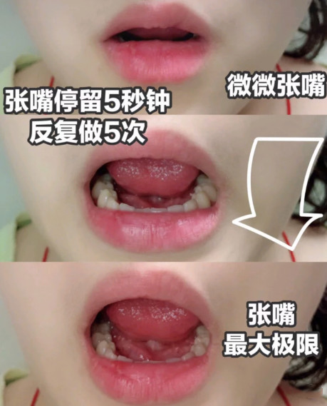 动作六,微微张开嘴保持五秒钟,接着中度张开嘴保持5秒以上,最后尽最大