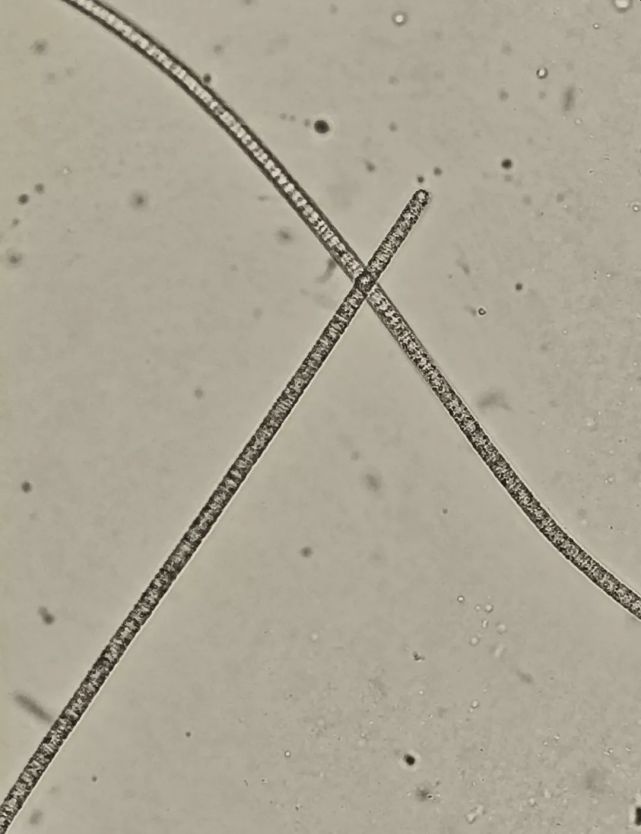 显微镜下正在移动的贝氏硫化细菌
