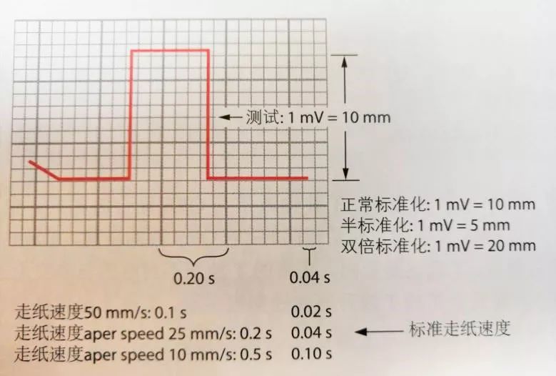 心电图|心电图上的这个小细节，你是不是也忽略了？