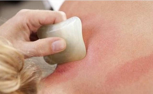 女人常刮痧,排毒又养颜,身上4个地方多刮刮,好处或令你惊喜!