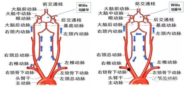 前交通动脉位置图片