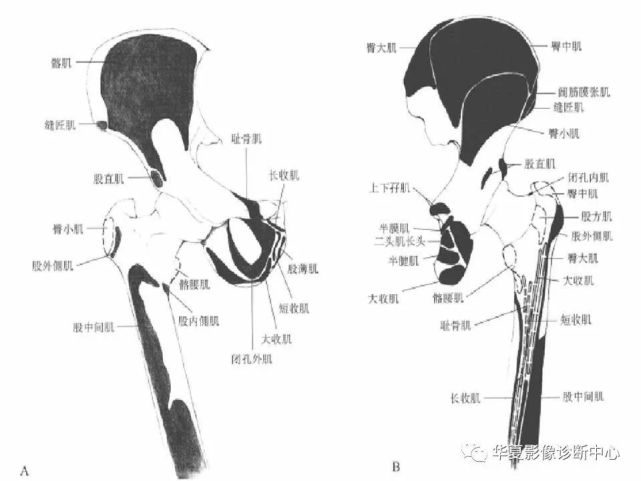 值得收藏的髋关节全面解剖