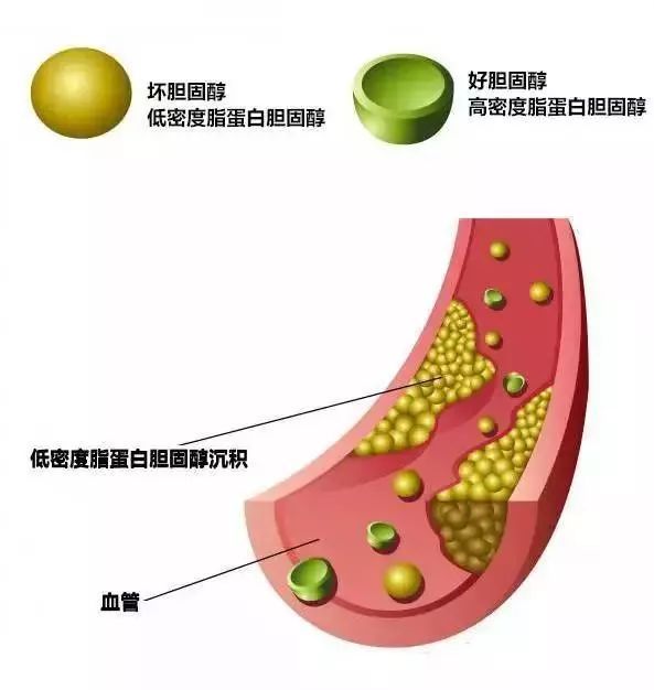 低密度脂蛋白胆固醇|为什么要降低低密度脂蛋白胆固醇？