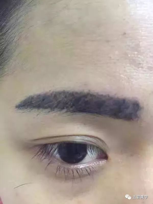 腾讯内容开放平台