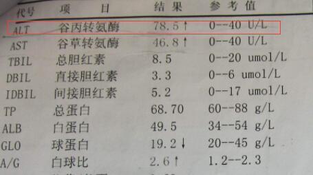 转氨酶升高就是肝病专家辟谣转氨酶升高有5种原因